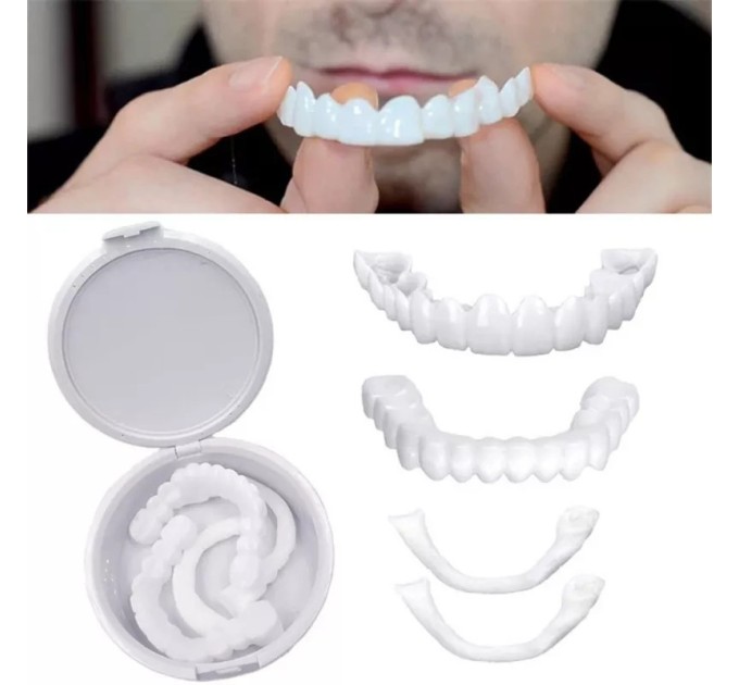 Snap On Smile Veneers: Идеальные съемные виниры для верхней и нижней челюсти