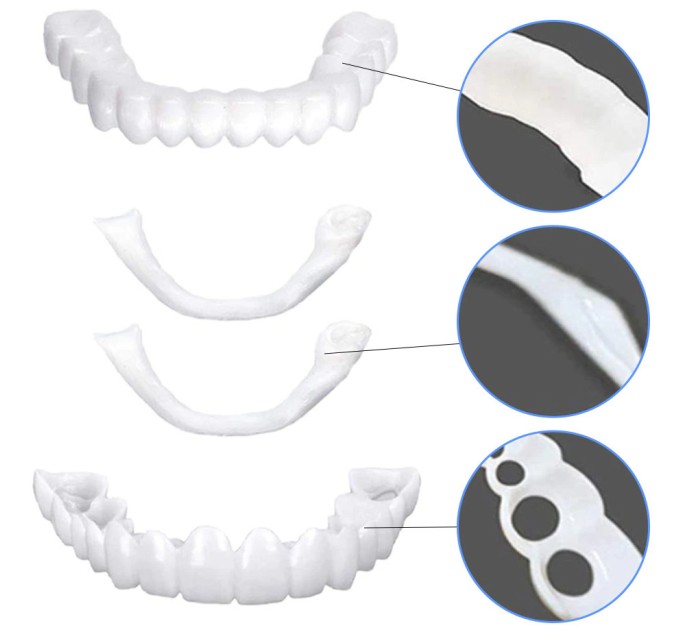 Забезпечте ідеальний посмішку зі знімними вінірами Snap On Smile Veneers та кейсом на agon-v.com.ua