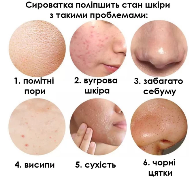 Сыворотка для лица Sersanlove Rose Essence 30 мл: Эксклюзивный уход за кожей от Агонь-В